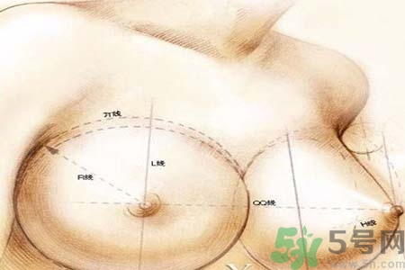 乳頭內陷可以用吸奶器嗎？乳頭內陷能不能用吸奶器？