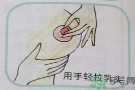乳頭內陷可以拔罐嗎？乳頭內陷需要手術治療嗎？