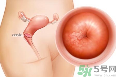 陰道干澀的原因是什么？陰道干澀怎么辦？