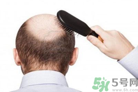 男性更年期的治療方法有哪些？如何預(yù)防男性更年期？