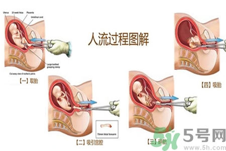人流后怎么調(diào)養(yǎng)身體？人流后飲食需注意什么？