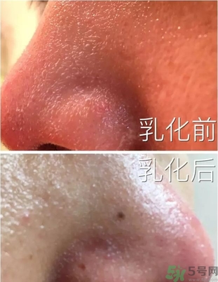 嬌韻詩吸盤潔面用法圖 嬌韻詩吸盤使用方法 嬌韻詩吸盤潔面用法圖 嬌韻詩吸盤使用方法