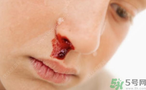 15歲男孩可以刮胡子嗎？15歲男孩經常流鼻血怎么回事？