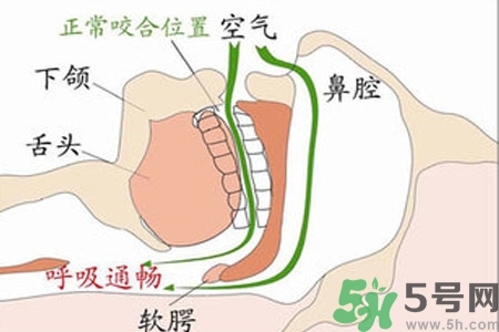 鼻子紅是什么原因？鼻子紅怎么辦？