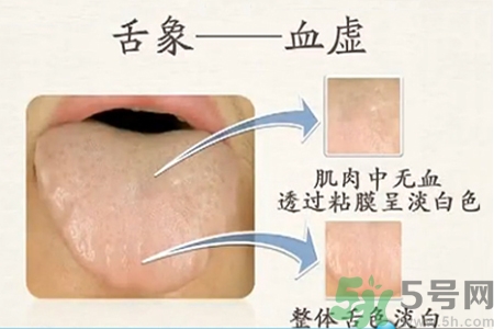 血虛的癥狀是什么？血虛的表現(xiàn)有哪些？