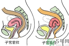 子宮移位的原因是什么？子宮移位的癥狀有哪些？