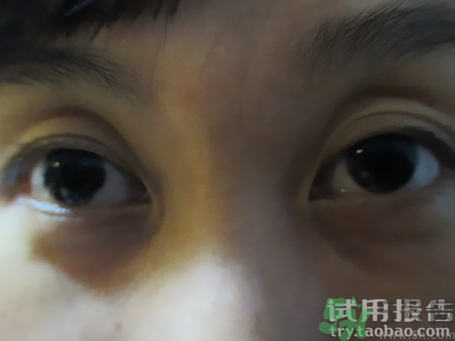 蛇毒眼膜效果怎么樣？spa蛇毒眼膜紅色好用嗎？
