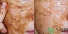 思親膚在韓國(guó)什么檔次？skin food在韓國(guó)怎么樣？