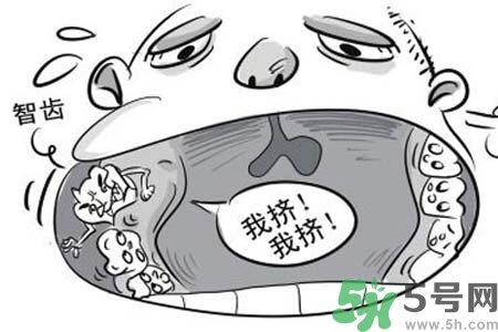 智齒橫著長(zhǎng)怎么辦？智齒橫著長(zhǎng)一定要拔了嗎？