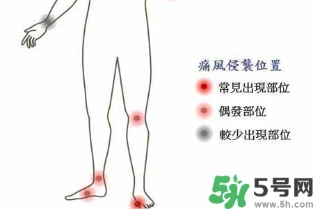 引發痛風的原因是什么？痛風病人飲食需注意什么好？