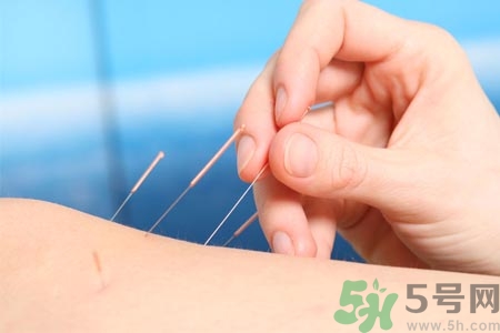 針灸一次要扎多長時間？針灸可以幾天做一次？