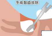 智齒拔完后有個洞怎么辦？拔智齒后有個洞多久能長好？