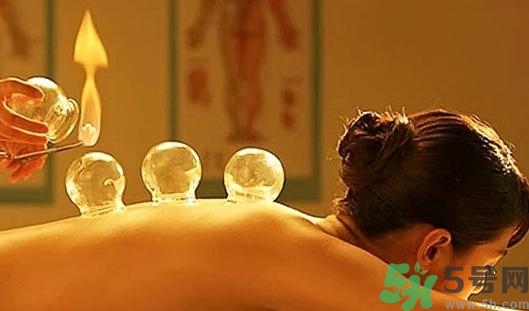 在家拔罐需要注意什么？在家拔罐幾天拔一次？