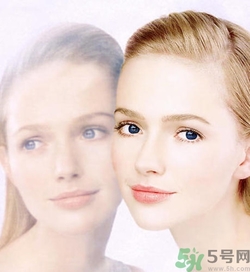 曬斑可以自己消退嗎？曬斑可以用激光去除嗎？
