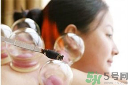 肩膀酸痛可以拔火罐嗎？孕婦肩膀酸痛能拔火罐嗎？