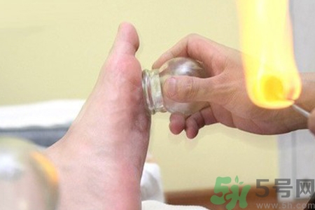 腳底拔罐能去濕氣嗎？腳底拔罐出現青紫正常嗎？
