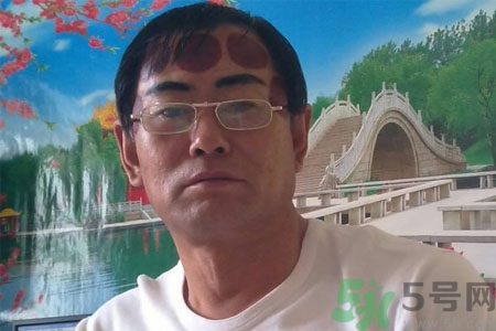 頭痛可以在額頭上拔火罐嗎？額頭上拔火罐有什么好處？