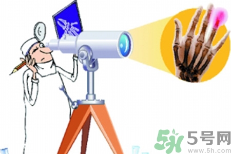 什么年齡測骨齡最好？如何測骨齡？