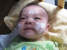 新生兒濕疹可以用爐甘石洗劑嗎？新生兒濕疹的護理措施