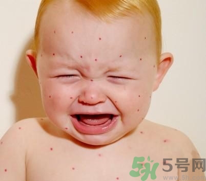 新生兒濕疹怎么引起的？新生兒濕疹如何處理？