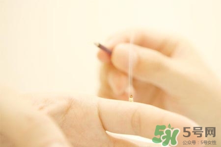 面癱能艾灸嗎？艾灸能治療面癱嗎？
