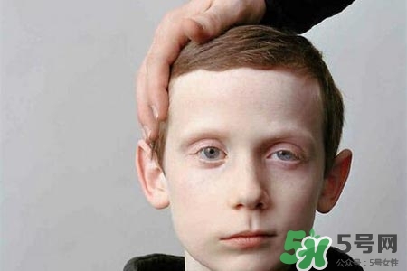 青少年面癱是怎么回事?青少年面癱是怎么辦? 青少年面癱是怎么回事?青少年面癱是怎么辦?
