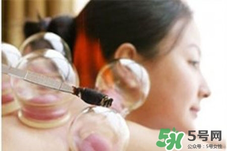 拔罐放血對身體好嗎？拔罐放血有什么好處？