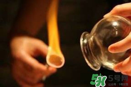 拔罐放血對身體好嗎？拔罐放血有什么好處？