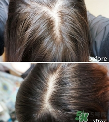 hairmax激光生發梳怎么用?hairmax激光生發梳使用心得