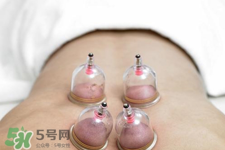 冬天拔罐好還是刮痧好？冬天刮痧和拔罐哪個效果好？