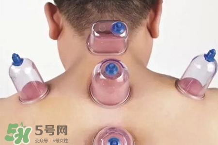 拔罐后可以喝酒嗎？拔罐后多久能喝酒？