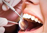 拔牙之后可以吃藥嗎？拔牙之后要不要吃藥？