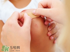 創可貼多久換一次?創可貼多長時間換一次?