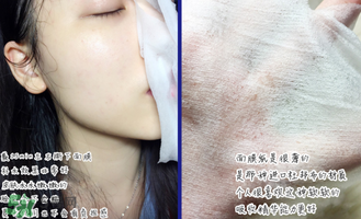 稚優泉面膜怎么用？稚優泉面膜要洗嗎？