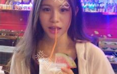 定點(diǎn)雙眼皮能保持多久？定點(diǎn)雙眼皮是永久的嗎？