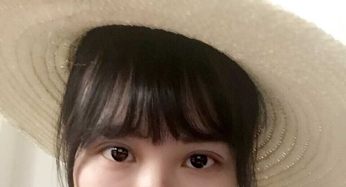 定點雙眼皮恢復過程圖_定點雙眼皮要多久恢復