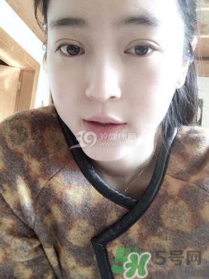 什么是定點雙眼皮？定點雙眼皮多少錢？