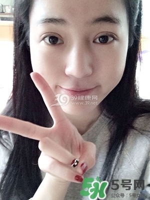 什么是定點雙眼皮？定點雙眼皮多少錢？