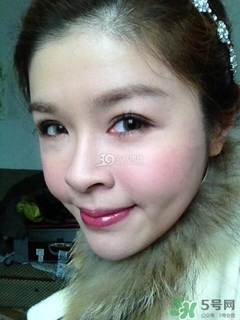 重瞼術是什么？重瞼術是永久的嗎？