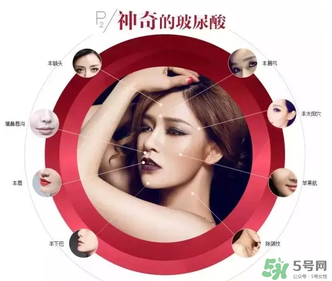 喬雅登是哪個國家的？喬雅登玻尿酸哪個國家？