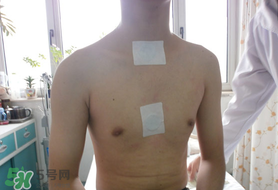 三九貼怎么貼？三九貼的貼法