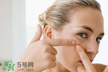 膠原蛋白能祛痘嗎？膠原蛋白可以祛痘嗎？