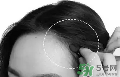 發際線高適合什么發型？發際線高怎么辦