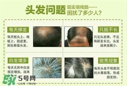 牛角梳梳頭可以生發(fā)嗎？牛角梳怎么梳頭？