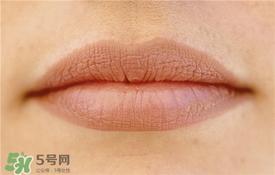 卡唇紋是什么意思？卡唇紋怎么辦？