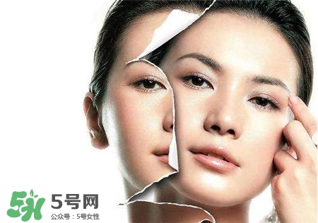 美白針是什么？美白針可以連續(xù)打嗎？