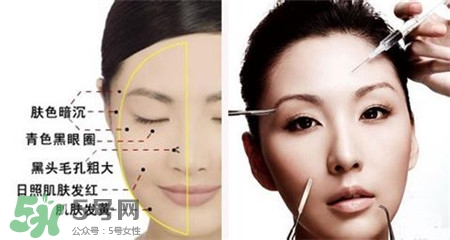 美白針的效果明顯嗎？美白針一個療程幾次？