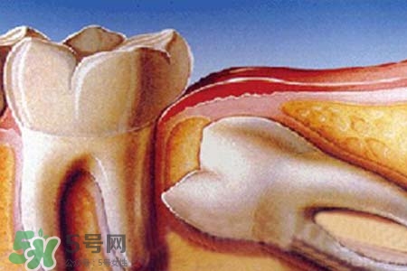 智齒會一直長嗎？智齒會停止生長嗎？