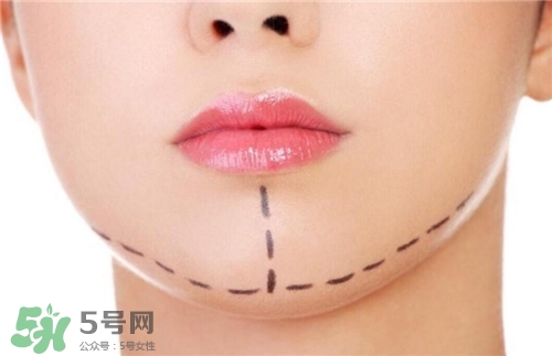 玻尿酸墊下巴能維持多久？玻尿酸墊下巴能維持多長時間？