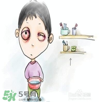 紅眼病是怎么引起的？紅眼病怎么產生的